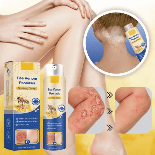 Basicxl | Øjeblikkelig lindring af genstridig psoriasis