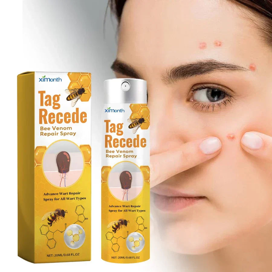 Basicxl | TagAway – Effektiv behandling mod vorter og hudvorter